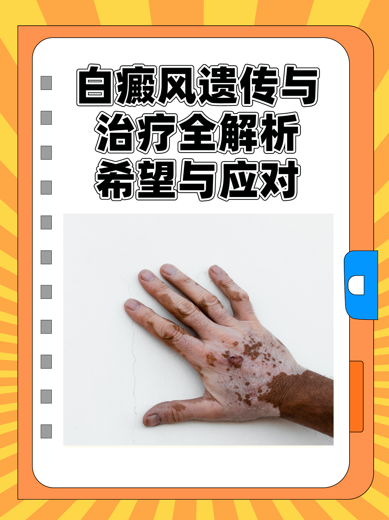 白癜风最新治疗技术，重塑自信，笑迎人生挑战